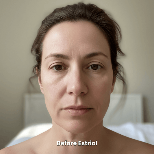 Why Estriol Cream Won't Wreck Your HRT (But Will Fix Your Face)