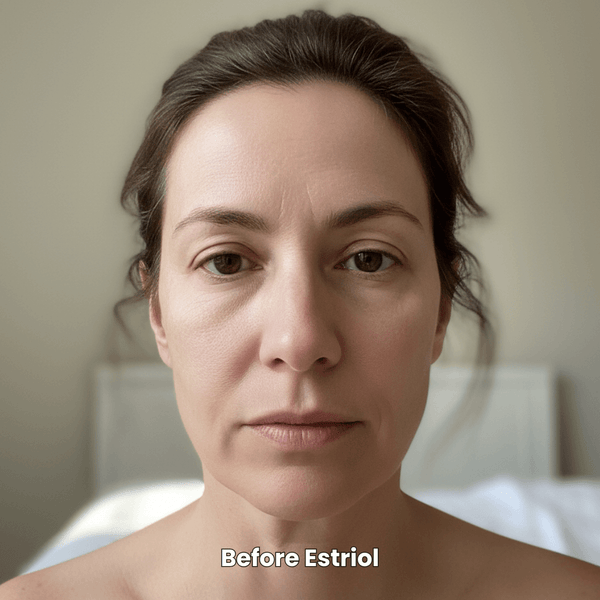 Why Estriol Cream Won't Wreck Your HRT (But Will Fix Your Face)